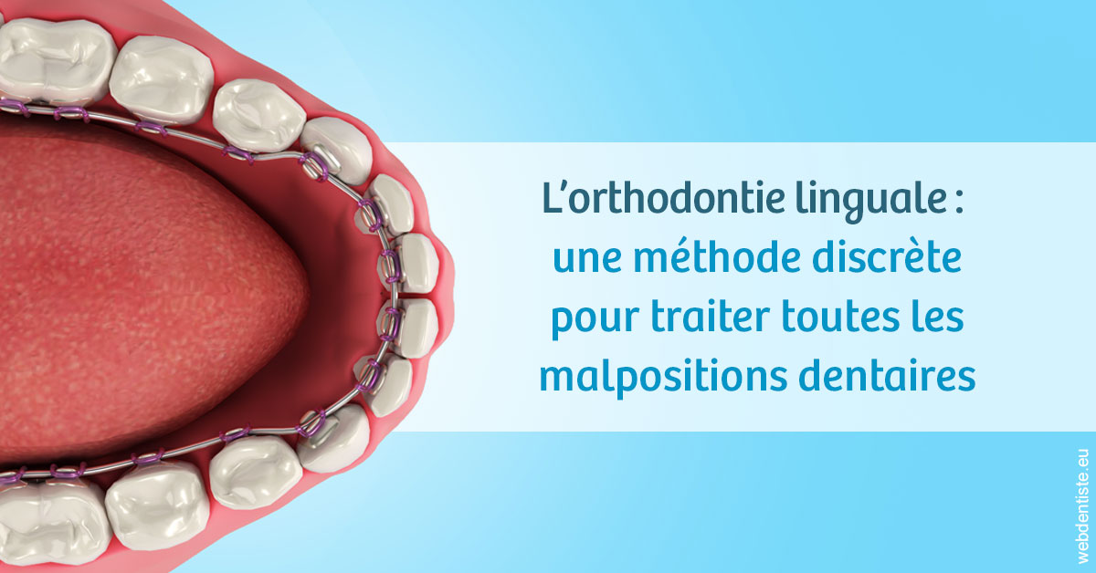 https://dr-bordes-maryse.chirurgiens-dentistes.fr/L'orthodontie linguale 1