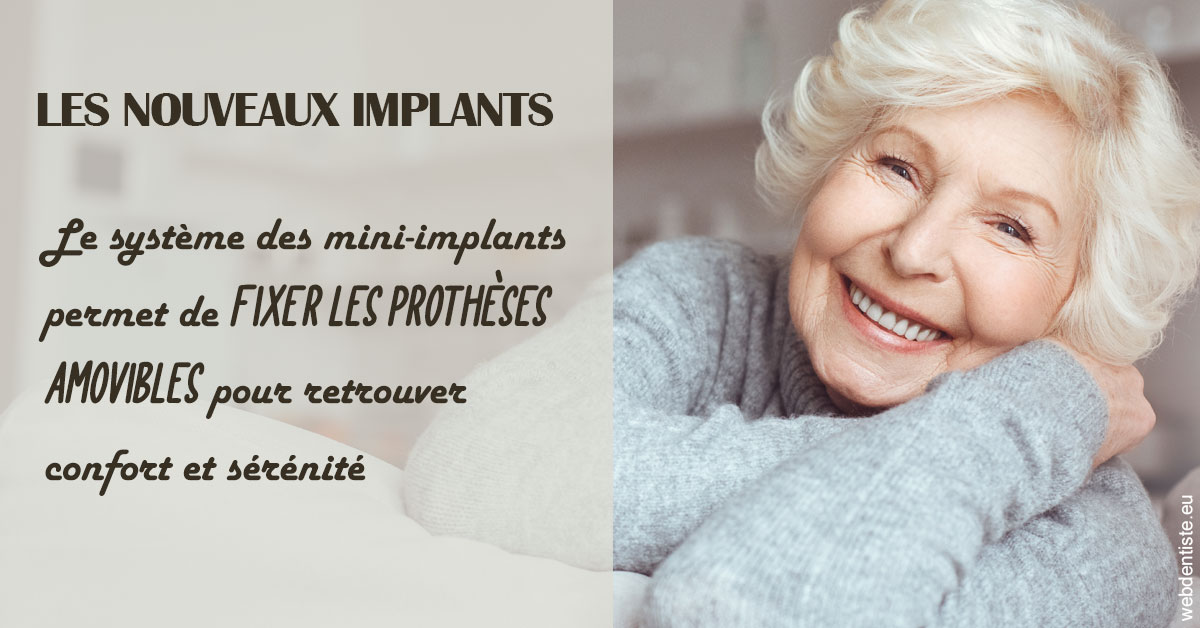 https://dr-bordes-maryse.chirurgiens-dentistes.fr/Les nouveaux implants 1