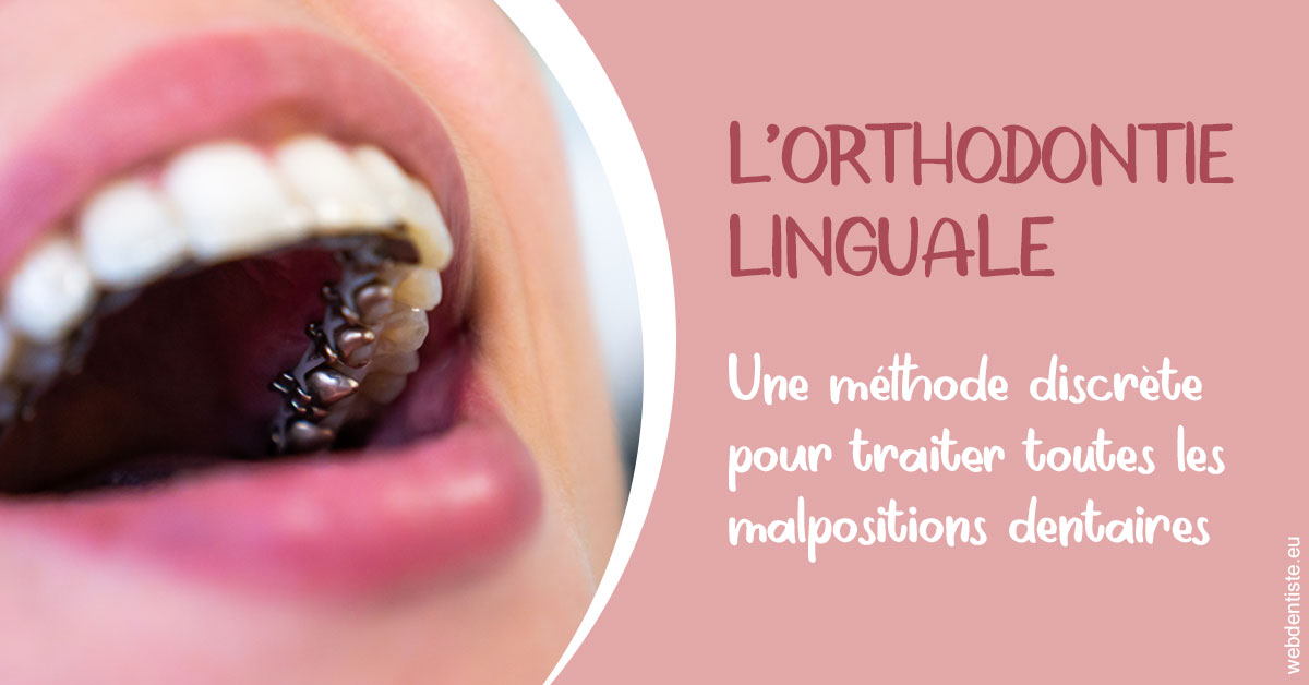 https://dr-bordes-maryse.chirurgiens-dentistes.fr/L'orthodontie linguale 2