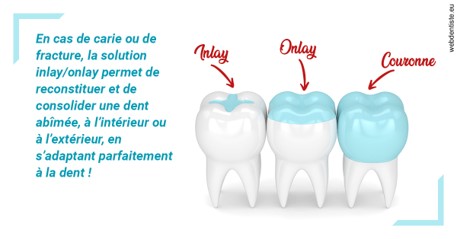 https://dr-bordes-maryse.chirurgiens-dentistes.fr/L'INLAY ou l'ONLAY