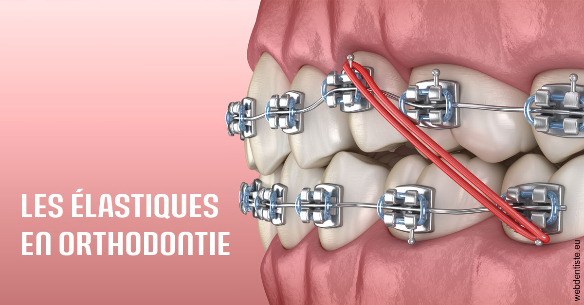 https://dr-bordes-maryse.chirurgiens-dentistes.fr/Elastiques orthodontie 2