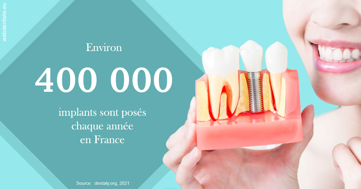 https://dr-bordes-maryse.chirurgiens-dentistes.fr/Pose d'implants en France 2