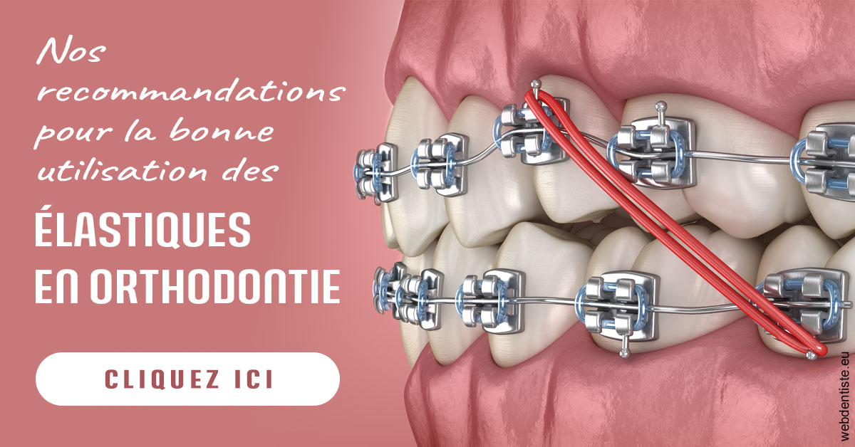 https://dr-bordes-maryse.chirurgiens-dentistes.fr/Elastiques orthodontie 2