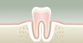 parodontologie1-275x145