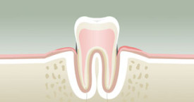 parodontologie2-275x145