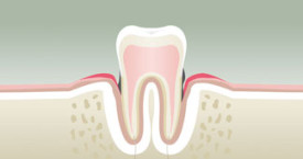 parodontologie3-275x145